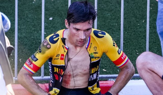 Roglic Así lucía Primoz Roglic, tras su caída en la Vuelta a España.
