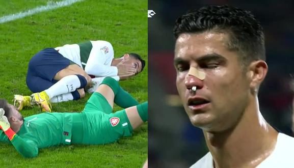 Ronaldo Duro choque de Cristiano con el portero checo. Video Captura ESPN