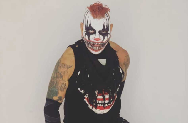 Pagano Pagano será sometido a una operación tras lesión por golpiza.