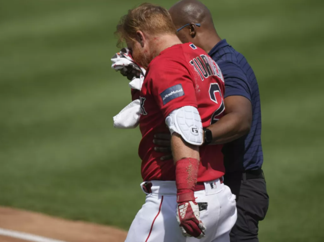 Turner está recibiendo tratamiento por una lesión en el tejido blando.
