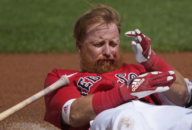 Turnerr Justin Turner recibió tremendo bolazo de parte de Matt Manning.